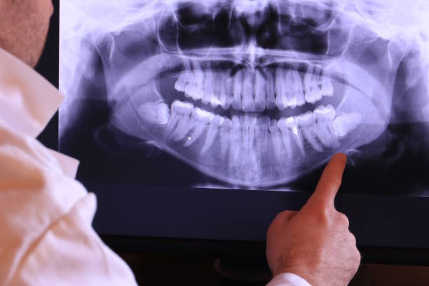 Best Broken or Cracked Tooth Emergency Dentist in Dalton, OH